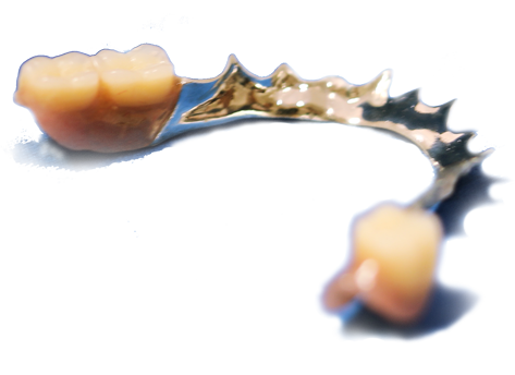 ＭＴコネクター