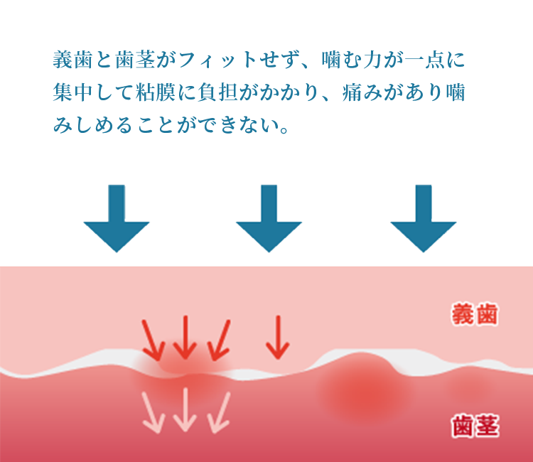 痛みがある噛むことができない状態