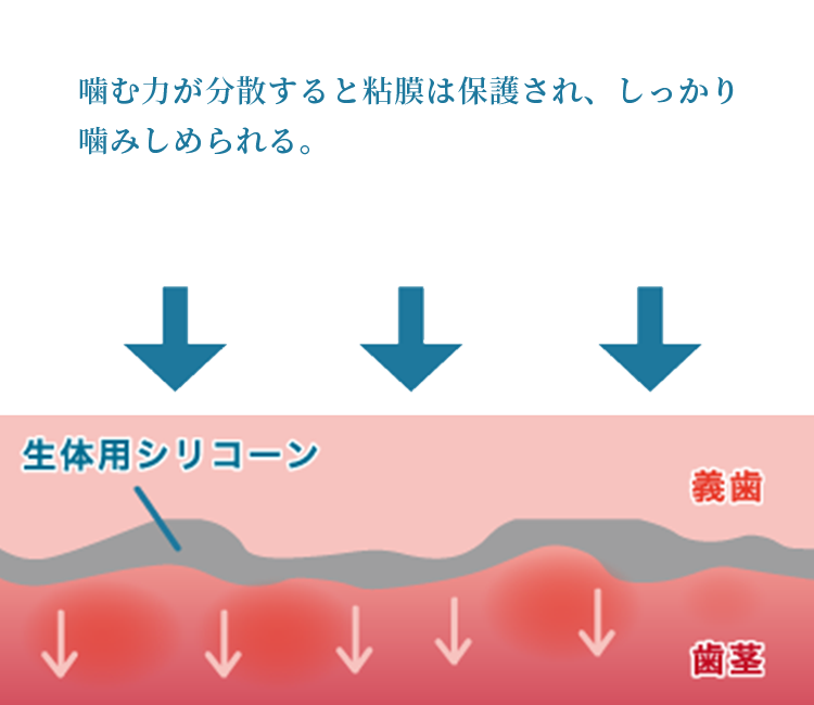 噛む力が分散され、粘膜が保護され噛み締められる状態